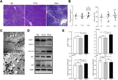 Aberrant regulation of autophagy disturbs fibrotic liver regeneration after partial hepatectomy